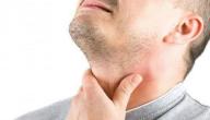 أعراض قصور الغدة الدرقية وعلاجه