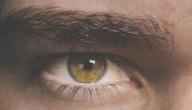 اصفرار العين وعلاجه