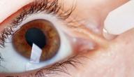 ما علاج حساسية العين
