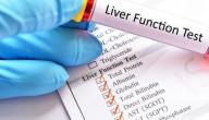 علاج زيادة انزيمات الكبد