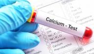 زيادة نسبة الكالسيوم في الدم