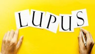 ما درجة خطورة مرض الذئبة الحمراء؟
