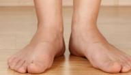 كيف تتخلص من تعرق القدمين؟