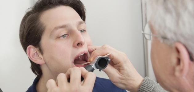 عملية استئصال اللوزتين