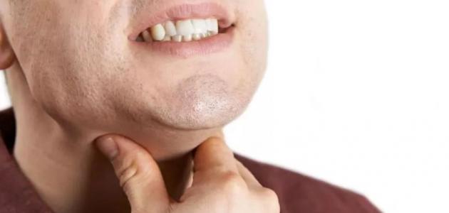علاج التهاب الحلق واللوزتين