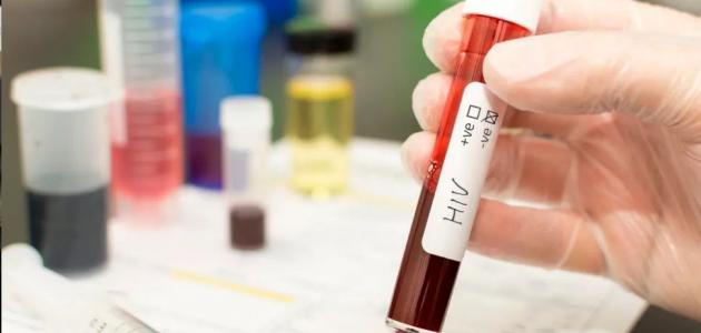 طرق انتقال مرض الإيدز
