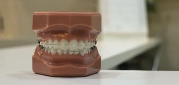 مميزات طب الأسنان