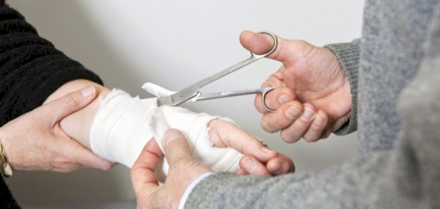 مراحل شفاء الحروق