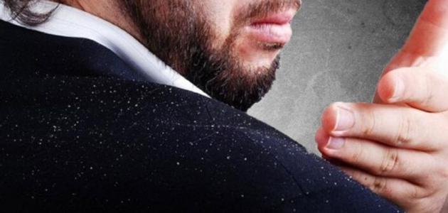طرق للتخلص من القشرة