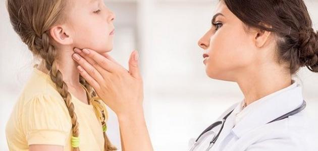 أعراض مرض النكاف