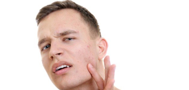 أعراض اضطراب الهرمونات