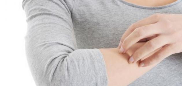 أسباب الحساسيّة الجلدية وعلاجها