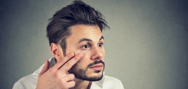 أسرع طريقة لإزالة كدمات العين