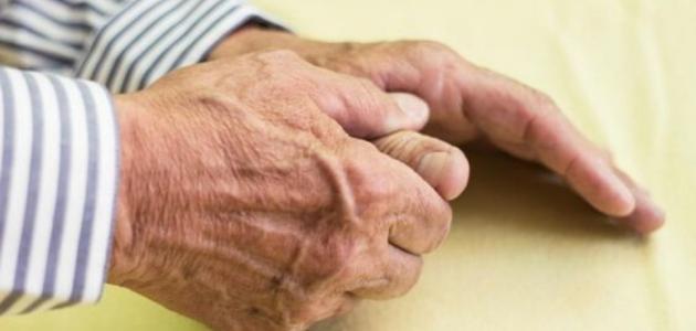 آثار النقرس