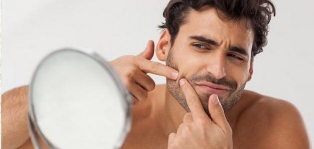 علاج للبشرة الدهنية