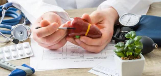 أعراض تليف الكبد