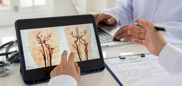 تمدد الأوعية الدموية: أنواعها وأعراضها