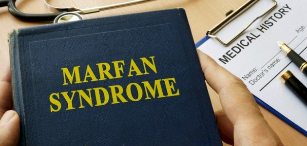 متلازمة مارفان: ما هي؟ وما علاماتها؟