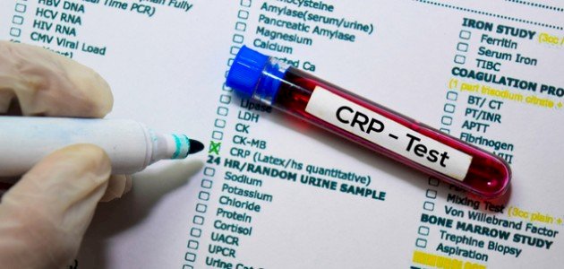 كل ما يهمك حول الCRP: البروتين المتفاعل