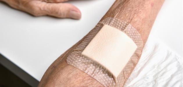 ما مدة التئام الجرح بعد الخياطة؟ إليك الإجابة