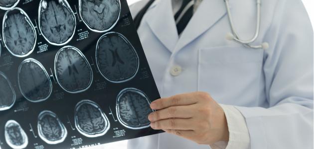 الأشعة المقطعية على المخ: أهميتها وطرق إجرائها