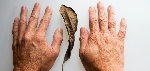 ما سبب ظهور بقع بنية خشنة على الجلد؟