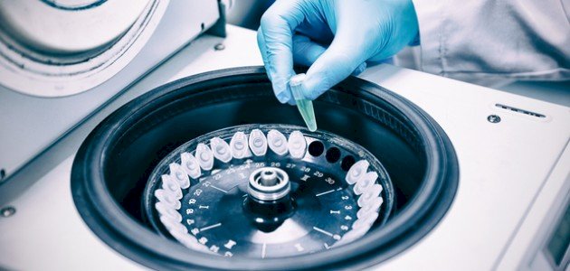 مبدأ عمل جهاز الطرد المركزي (Centrifuge)؟ وكيف يمكنك تشغيله؟