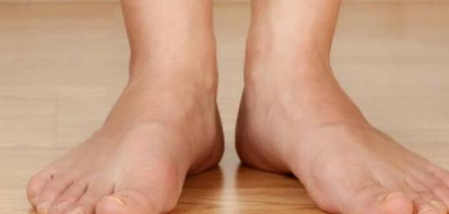 كيف تتخلص من تعرق القدمين؟