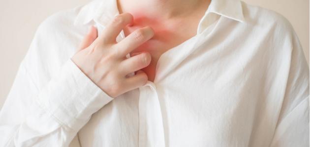علاج حكة المناطق الحساسه