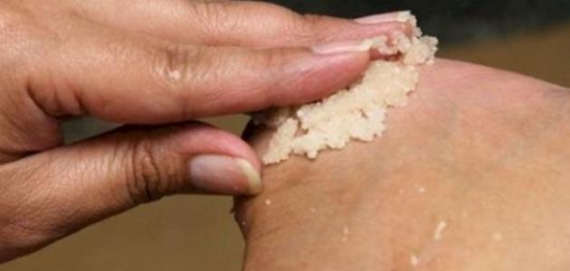 علاج تشقق كعب القدم