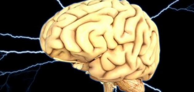 نقص التروية الدماغية
