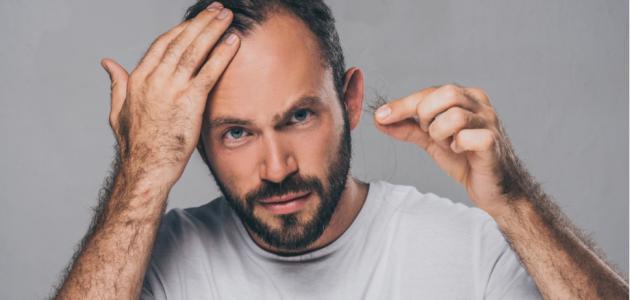 علاج تساقط الشعر بعد الفرد