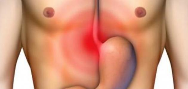 علاج نزيف المعدة