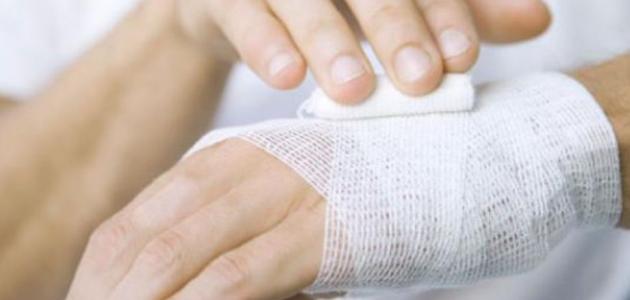 علاج الحروق